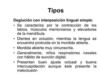 Tipos
Deglución con interposición lingual simple:
• Se caracteriza por la contracción de los
labios, músculos mentonianos y elevadores
de la mandíbula.
• Dientes en oclusión, mientras la lengua se
encuentra protruida en la mordida abierta.
• Mordida abierta muy circunscrita.
• Generalmente, niños respiradores nasales
con hábito de succión digital.
• Presentan buen ajuste oclusal y buena
intercuspidación aunque éste presente la
maloclusión
 
