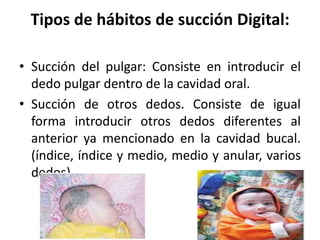 Tipos de hábitos de succión Digital:
• Succión del pulgar: Consiste en introducir el
dedo pulgar dentro de la cavidad oral.
• Succión de otros dedos. Consiste de igual
forma introducir otros dedos diferentes al
anterior ya mencionado en la cavidad bucal.
(índice, índice y medio, medio y anular, varios
dedos).
 