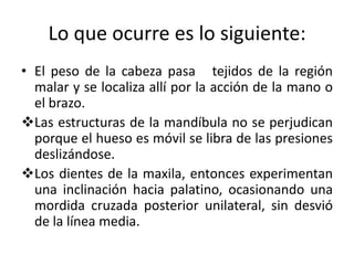 Lo que ocurre es lo siguiente:
• El peso de la cabeza pasa tejidos de la región
malar y se localiza allí por la acción de la mano o
el brazo.
Las estructuras de la mandíbula no se perjudican
porque el hueso es móvil se libra de las presiones
deslizándose.
Los dientes de la maxila, entonces experimentan
una inclinación hacia palatino, ocasionando una
mordida cruzada posterior unilateral, sin desvió
de la línea media.
 