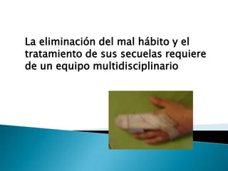 La eliminación del mal hábito y el
tratamiento de sus secuelas requiere
de un equipo multidisciplinario
 