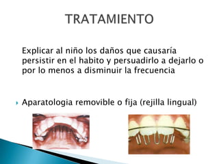 Explicar al niño los daños que causaría
persistir en el habito y persuadirlo a dejarlo o
por lo menos a disminuir la frecuencia
 Aparatologia removible o fija (rejilla lingual)
 