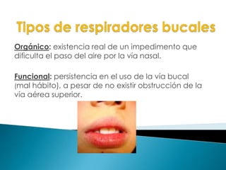 Orgánico: existencia real de un impedimento que
dificulta el paso del aire por la vía nasal.
Funcional: persistencia en el uso de la vía bucal
(mal hábito), a pesar de no existir obstrucción de la
vía aérea superior.
 