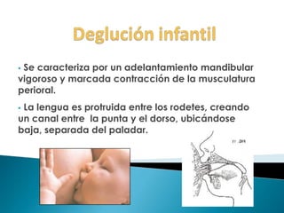  Se caracteriza por un adelantamiento mandibular
vigoroso y marcada contracción de la musculatura
perioral.
 La lengua es protruida entre los rodetes, creando
un canal entre la punta y el dorso, ubicándose
baja, separada del paladar.
 