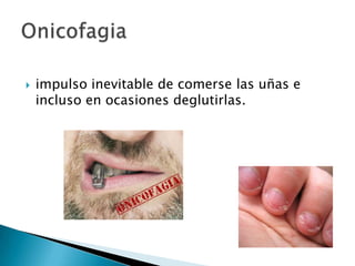  impulso inevitable de comerse las uñas e
incluso en ocasiones deglutirlas.
 