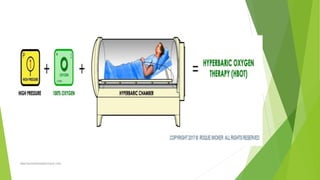 Hyperbaric oxygen therapy | PPTX