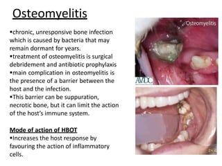 Osteomyelitis
chronic, unresponsive bone infection
which is caused by bacteria that may
remain dormant for years.
treatment of osteomyelitis is surgical
debridement and antibiotic prophylaxis
main complication in osteomyelitis is
the presence of a barrier between the
host and the infection.
This barrier can be suppuration,
necrotic bone, but it can limit the action
of the host’s immune system.
Mode of action of HBOT
Increases the host response by
favouring the action of inflammatory
cells.
 