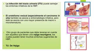  La infección del tracto urinario (ITU) puede semejar
los síntomas irritativos de la HBP.
 El urotelioma vesical (especialmente el carcinoma in
situ) también se asocia a sintomatología irritativa, pero
éste se asocia con una mayor presencia de macro o
microhematuria.
 Otro grupo de pacientes que debe tenerse en cuenta
son aquellos que tienen una vejiga neurógena, los
cuales pueden tener muchos síntomas sugerentes de
HBP,
 TU. De Vejiga
 
