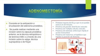  Consiste en la extirpación o
enucleación del adenoma prostático.
 Se puede realizar mediante una
incisión sobre la cápsula prostática
anterior, es la técnica retropúbica o
de terence-millin o a través de una
incisión sobre la vejiga, técnica
suprapúbica o de freyer
 
