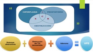 ”
“
Síntomas
obstructivos
Obstrucción
del TUI
demostrable
Adenoma HPB
 