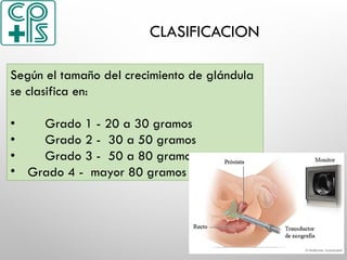 CLASIFICACION
Según el tamaño del crecimiento de glándula
se clasifica en:
• Grado 1 - 20 a 30 gramos
• Grado 2 - 30 a 50 gramos
• Grado 3 - 50 a 80 gramos
• Grado 4 - mayor 80 gramos
 