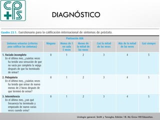 DIAGNÓSTICO
Urología general. Smith y Tanagho. Edición 18. Mc Graw Hill Education.
 