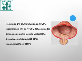 • Hematuria (2%-5% transfusión en RTUP).
• Incontinencia (2% en RTUP y 10% en abierta).
• Estenosis de uretra o cuello vesical (3%).
• Eyaculación retrógrada (80-90%).
• Impotencia (7% en RTUP).
COMPLICACIONES
 