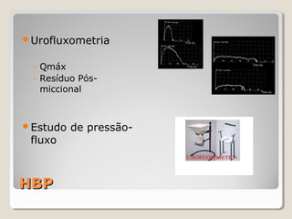 Urofluxometria

◦ Qmáx
◦ Resíduo Pósmiccional

Estudo

fluxo

HBP

de pressão-

 