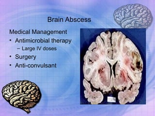 Brain Abscess Medical Management Antimicrobial therapy Large IV doses Surgery Anti-convulsant 