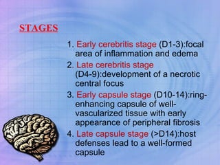 STAGES 1.  Early cerebritis stage  (D1-3):focal area of inflammation and edema 2 . Late cerebritis stage  (D4-9):development of a necrotic central focus 3.  Early capsule stage  (D10-14):ring-enhancing capsule of well-vascularized tissue with early appearance of peripheral fibrosis 4.  Late capsule stage  (>D14):host defenses lead to a well-formed capsule 