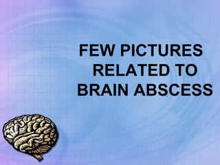 FEW PICTURES RELATED TO BRAIN ABSCESS 