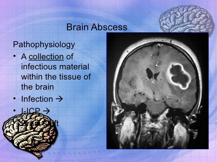 Brain Abscess Caused By Bacillus Megaterium In An Adult Patient – UVCS