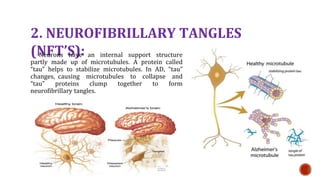 2. NEUROFIBRILLARY TANGLES
(NFTS):
Neurons have an internal support structure
partly made up of microtubules. A protein called
tau helps to stabilize microtubules. In AD, tau
changes, causing microtubules to collapse and
tau proteins clump together to form
neurofibrillary tangles.
 
