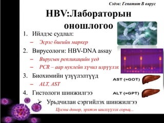 HBV:Лабораторын 
оношлогоо 
1. Ийлдэс судлал: 
– Эсрэг биеийн маркер 
2. Вирусологи: HBV-DNA assay 
– Вирусын репликацийн үед 
– PCR – аар нуклейн хүчил илрүүлэх 
3. Биохимийн үзүүлэлтүүд 
– ALT, AST 
4. Гистологи шинжилгээ 
 Урьдчилан сэргийлэх шинжилгээ 
Цусны донор, эрхтэн шилхүүлэх сорьц... 
 