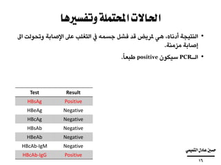 ‫وتفسريها‬‫احملتملة‬‫احلاالت‬
•‫النتيجة‬،‫أدناه‬‫هي‬‫ملريض‬‫قد‬‫فشل‬‫جسمه‬‫يف‬‫التغلب‬‫عىل‬‫اإلصابة‬‫وت‬‫حولت‬‫اىل‬
‫إصابة‬‫مزمنة‬.
•‫الـ‬PCR‫سيكون‬positive‫ا‬‫طبعا‬.
ResultTest
PositiveHBsAg
NegativeHBeAg
NegativeHBcAg
NegativeHBsAb
NegativeHBeAb
NegativeHBcAb-IgM
PositiveHBcAb-IgG
‫التميمي‬‫عادل‬‫حسني‬
‫ــــــــــــــــــــــــــــــــــــــــ‬
16
 