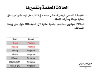 ‫وتفسريها‬‫احملتملة‬‫احلاالت‬
•‫النتيجة‬،‫أدناه‬‫هي‬‫ملريض‬‫قد‬‫فشل‬‫جسمه‬‫يف‬‫التغلب‬‫عىل‬‫اإلصابة‬‫وت‬‫حولت‬‫اىل‬
‫إصابة‬‫مزمنة‬‫ومازالت‬‫نشطة‬.
•‫الـ‬PCR‫سيكون‬positive‫بنسبة‬‫عالية‬‫ألن‬‫الـ‬HBeAg‫دليل‬‫عىل‬‫زيادة‬
‫التضاعف‬.
ResultTest
PositiveHBsAg
PositiveHBeAg
NegativeHBcAg
NegativeHBsAb
NegativeHBeAb
NegativeHBcAb-IgM
NegativeHBcAb-IgG
‫التميمي‬‫عادل‬‫حسني‬
‫ــــــــــــــــــــــــــــــــــــــــ‬
17
 