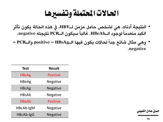 ‫وتفسريها‬‫احملتملة‬‫احلاالت‬
•‫النتيجة‬،‫أدناه‬‫هي‬‫لشخص‬‫حامل‬‫مزمن‬‫لـ‬HBV،‫يف‬‫هذه‬‫الحالة‬‫يكون‬‫تأثر‬
‫الكبد‬‫ا‬‫منعدما‬‫لوجود‬‫الـ‬HBeAb.‫ا‬‫غالبا‬‫سيكون‬‫الـ‬PCR‫نتيجته‬negative.
•‫وهي‬‫مثال‬‫شائع‬‫ا‬‫جدا‬‫لحاالت‬‫يكون‬‫فيها‬‫الـ‬HBsAg=positive‫والـ‬PCR=
negative.
ResultTest
PositiveHBsAg
NegativeHBeAg
NegativeHBcAg
NegativeHBsAb
PositiveHBeAb
NegativeHBcAb-IgM
NegativeHBcAb-IgG
‫التميمي‬‫عادل‬‫حسني‬
‫ــــــــــــــــــــــــــــــــــــــــ‬
18
 