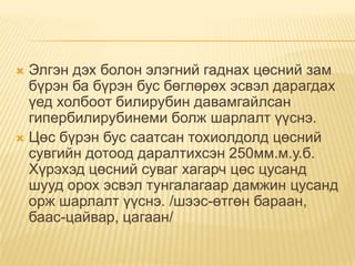 Элгэн дэх болон элэгний гаднах цөсний зам
бүрэн ба бүрэн бус бөглөрөх эсвэл дарагдах
үед холбоот билирубин давамгайлсан
гипербилирубинеми болж шарлалт үүснэ.
 Цөс бүрэн бус саатсан тохиолдолд цөсний
сувгийн дотоод даралтихсэн 250мм.м.у.б.
Хүрэхэд цөсний суваг хагарч цөс цусанд
шууд орох эсвэл тунгалагаар дамжин цусанд
орж шарлалт үүснэ. /шээс-өтгөн бараан,
баас-цайвар, цагаан/


 