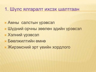 1. Шүлс ялгаралт ихсэх шалтгаан
Амны салстын үрэвсэл
 Шүдний орчны зөөлөн эдийн үрэвсэл
 Хэлний үрэвсэл
 Бөөлжилтийн өмнө
 Жирэмсний эрт үеийн хордлого


 