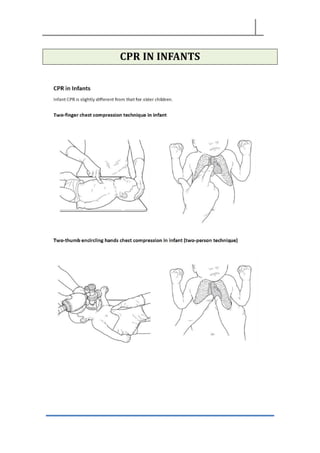 CPR IN INFANTS
 