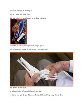 học 40 em, em hạng 1, em hạng 40
giày số 1, số 9, như lớp 1, lớp 9
nhìn hình bé này: 4 tuổi còn quay lại gặp bs vì chân cong
khi trẻ lớn lên, mổ là phức tạp hơn cắt gân gót qua da
xem mô hình này, chân sẽ tái phát lại nếu không mang giày
phải nói với bé: giày đẹp
bỏ ra bao giờ cũng dễ, mang lại bao giờ cũng khó
bỏ khi ngủ ban ngày là nguy hiểm, sau đó, trẻ sẽ bắt đầu không mang khi ngủ đêm