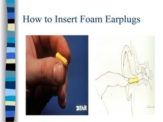 How to Insert Foam Earplugs
 