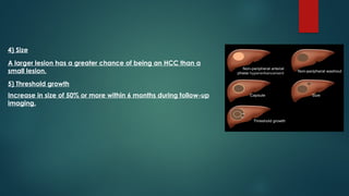 Li Rads Hcc Work Up Algorithm Comprehensive Overview of HCC Imaging and LI-RADS Classification | PPTX