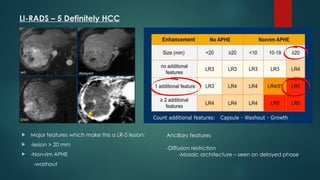 Li Rads Hcc Work Up Algorithm Comprehensive Overview of HCC Imaging and LI-RADS Classification | PPTX