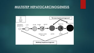 Li Rads Hcc Work Up Algorithm Comprehensive Overview of HCC Imaging and LI-RADS Classification | PPTX