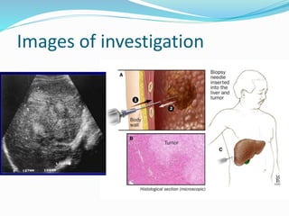 Images of investigation
 