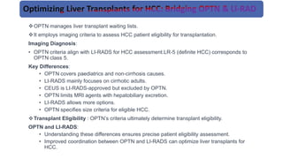 Optn Classification Hepatocellular carcinoma: clinical feature.pptx