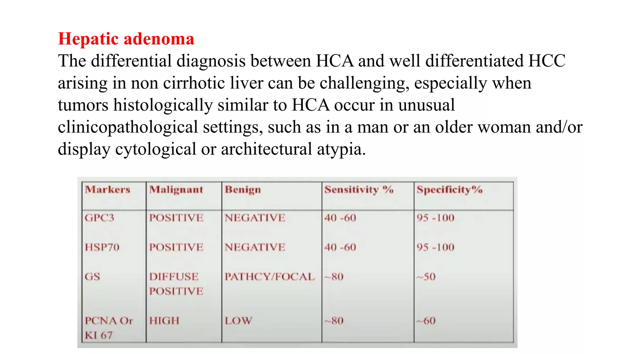 Hepatocellular carcinoma | PPTX