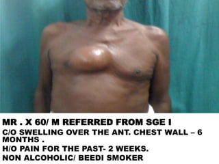 MR . X 60/ M REFERRED FROM SGE I
C/O SWELLING OVER THE ANT. CHEST WALL – 6
MONTHS .
H/O PAIN FOR THE PAST- 2 WEEKS.
NON ALCOHOLIC/ BEEDI SMOKER
 