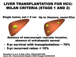LIVER TRANSPLANTATION FOR HCC:
 MILAN CRITERIA (STAGE 1 AND 2)

Single tumor, not > 5 cm Up to 3tumors, none>3Cm




                         +
     Absence of macroscopic vascular invasion,
          absence of extrahepatic spread
 • 5-yr survival with transplantation: ~ 70%
 • 5-yr recurrent rates: < 15%
Mazzaferro V, et al. N Engl J Med. 1996;334:693-699.
Llovet JM. J Gastroenterol Hepatol. 2002;17(suppl 3):S428-S433.
 