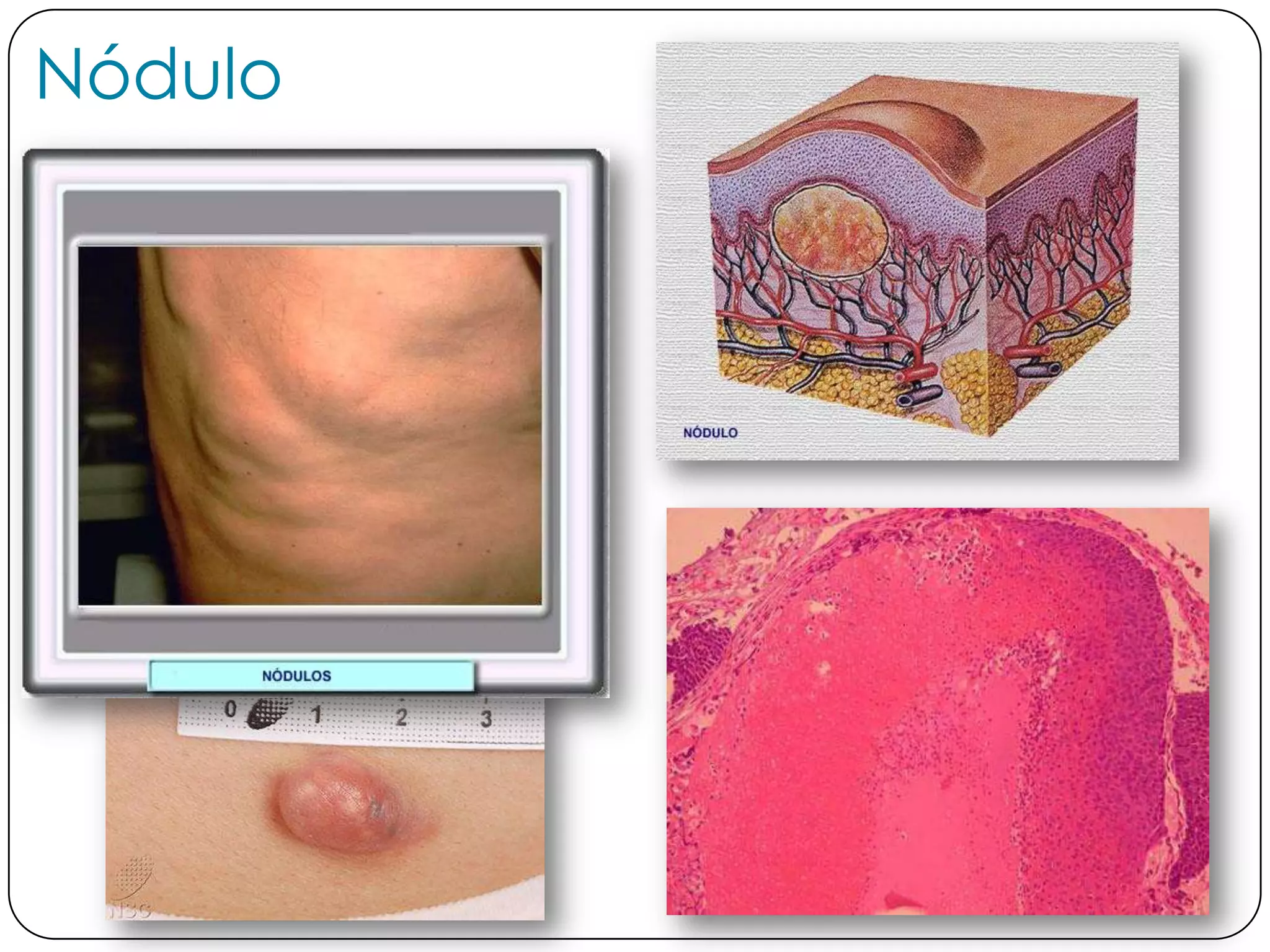 historia-cl-nica-dermatol-gica-y-lesiones-elementales-pptx
