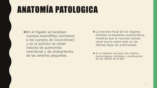 ANATOMÍA PATOLOGICA
En el hígado se localizan
cuerpos eosinófilos (similares
a los cuerpos de Councilman)
y en el pulmón se notan
indicios de pulmonitis
intersticial y de endoarteritis
de las arterias pequeñas.
 La necrosis focal de los órganos
linfoides es bastante característica,
mientras que la necrosis tubular
renal ocurre sobre todo en las
últimas fases de enfermedad.
 En el sistema nervioso hay infartos
hemorrágicos múltiples y proliferación
de las células de la glía
7
 