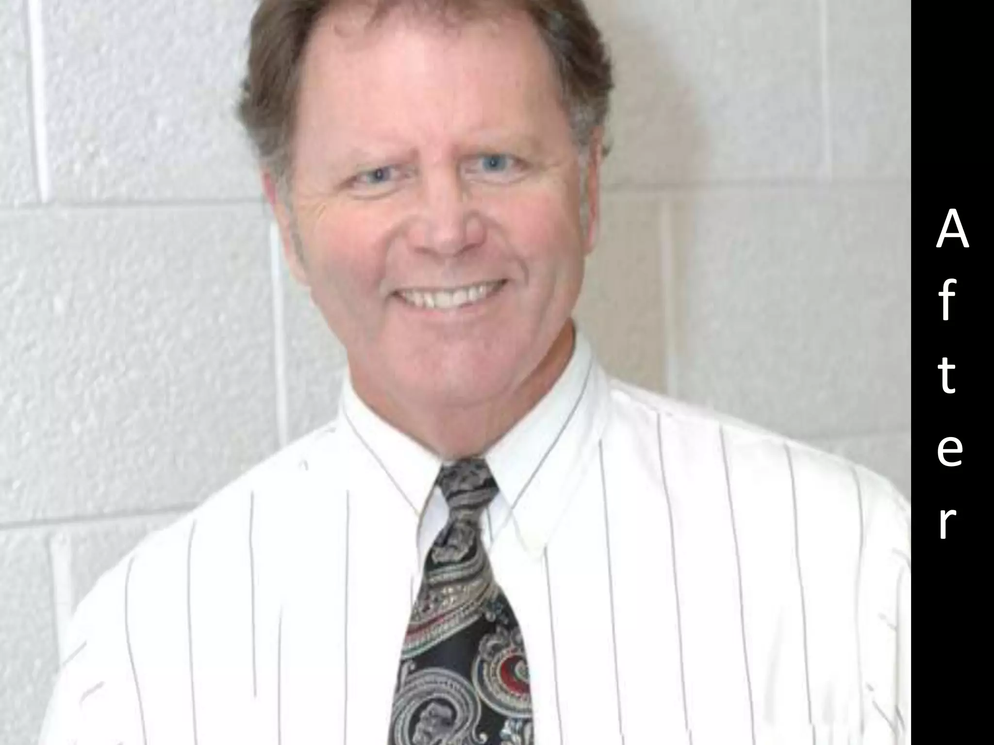 Hcg Protocol Low Calorie Diet