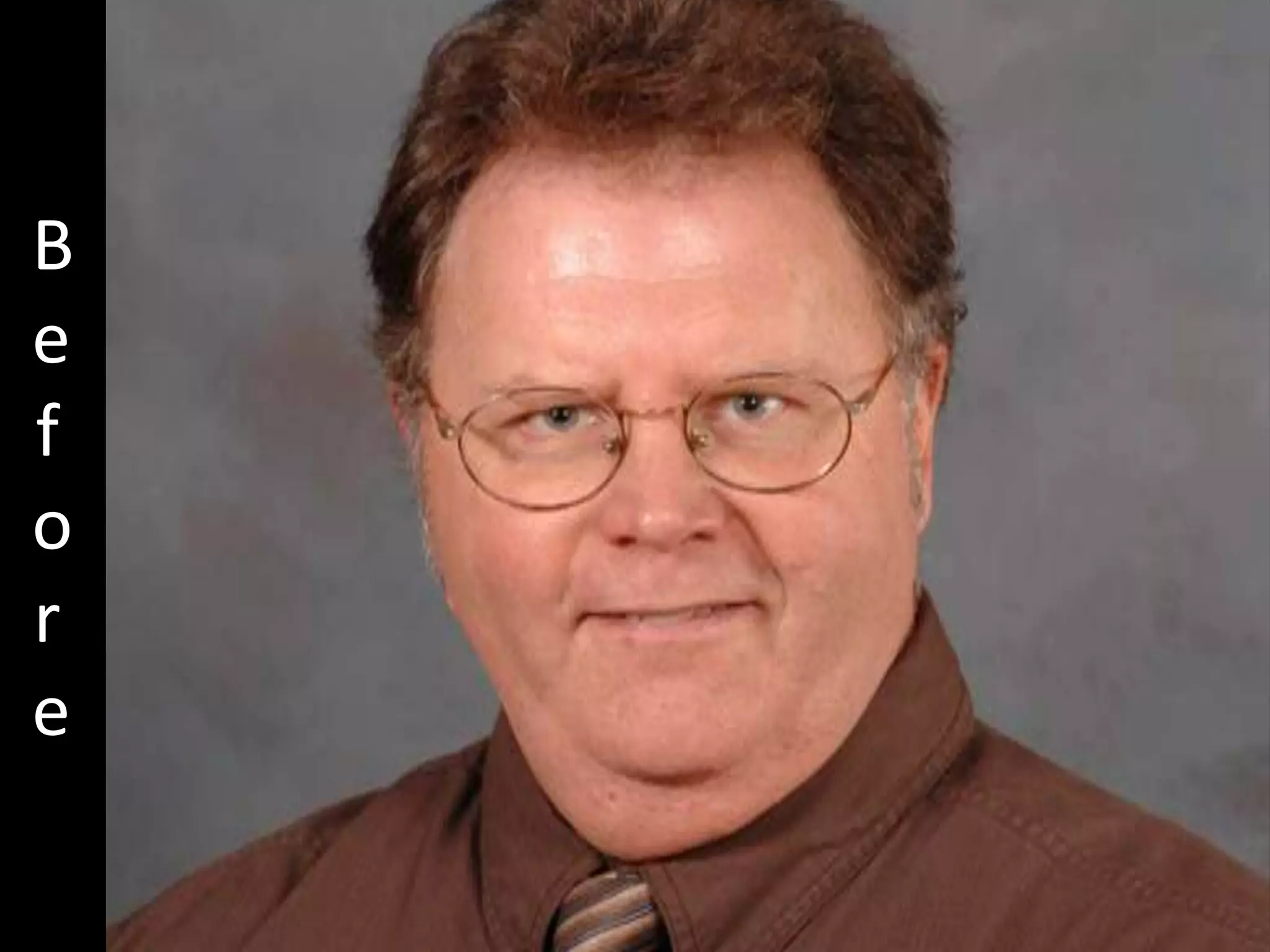 Hcg Protocol Low Calorie Diet