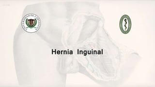 Hernia Inguinal
 