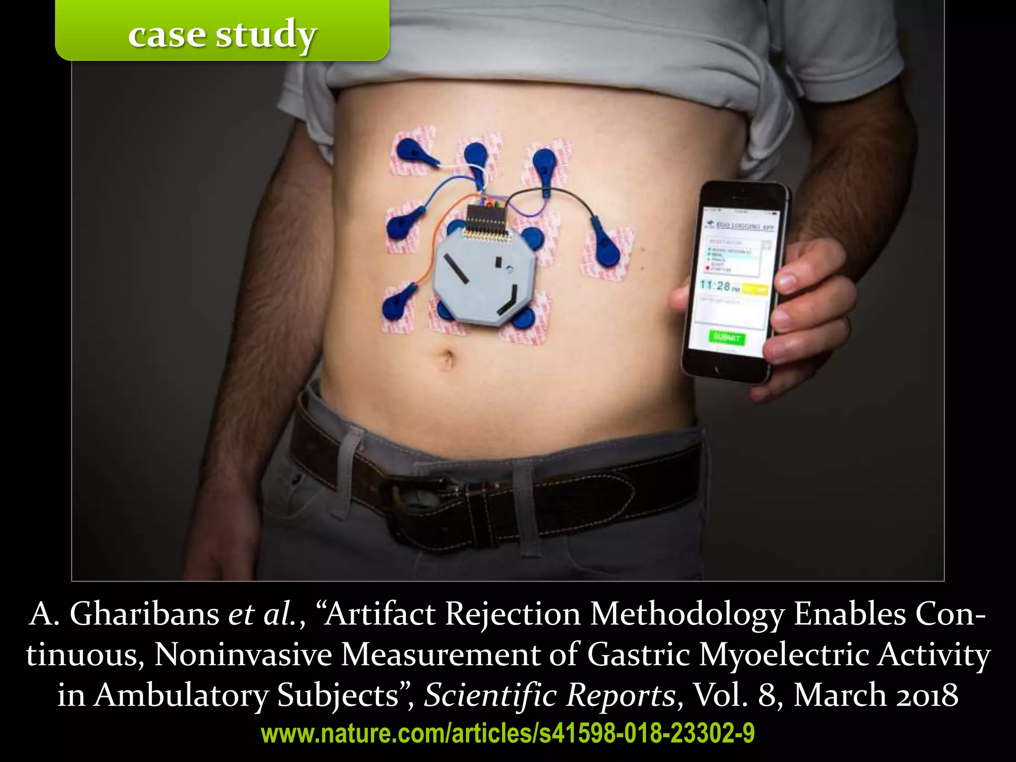 Master on Software Engineering :: Human-Computer Interaction
Dr. Sabin-Corneliu Buraga – profs.info.uaic.ro/~busaco/
case study
A. Gharibans et al., “Artifact Rejection Methodology Enables Con-
tinuous, Noninvasive Measurement of Gastric Myoelectric Activity
in Ambulatory Subjects”, Scientific Reports, Vol. 8, March 2018
www.nature.com/articles/s41598-018-23302-9
 