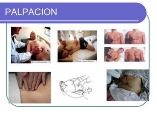 PALPACION
 