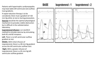 Patients with hypertrophic cardiomyopathy
may have labile left ventricular (LV) outflow
tract gradients.
If septal reduction therapy is to be
considered, there must a gradient of >50
mm Hg either at rest or during provocation.
Exercise would be the optimal physiological
mechanism to provoke a labile obstruction
but is difficult in the catheterization
laboratory.
Isoproterenol infusion is an excellent
method to simulate exercise by stimulating
both B1 and B2 receptors.
Left, There is no left ventricular outflow
gradient at rest.
Middle, With initial infusion of
isoproterenol, there is a 40-mm Hg gradient
across the left ventricular outflow tract.
Right, With a greater infusion of
isoproterenol, there is a 65-mm Hg left
ventricular outflow gradient
 