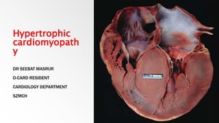Hypertrophic
cardiomyopath
y
DR SEEBAT MASRUR
D-CARD RESIDENT
CARDIOLOGY DEPARTMENT
SZMCH
 
