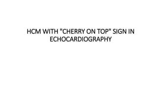 HCM WITH "CHERRY ON TOP" SIGN IN
ECHOCARDIOGRAPHY
 