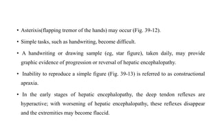 • Asterixis(flapping tremor of the hands) may occur (Fig. 39-12).
• Simple tasks, such as handwriting, become difficult.
• A handwriting or drawing sample (eg, star figure), taken daily, may provide
graphic evidence of progression or reversal of hepatic encephalopathy.
• Inability to reproduce a simple figure (Fig. 39-13) is referred to as constructional
apraxia.
• In the early stages of hepatic encephalopathy, the deep tendon reflexes are
hyperactive; with worsening of hepatic encephalopathy, these reflexes disappear
and the extremities may become flaccid.
 
